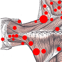 NMT and the Dynamic Foot